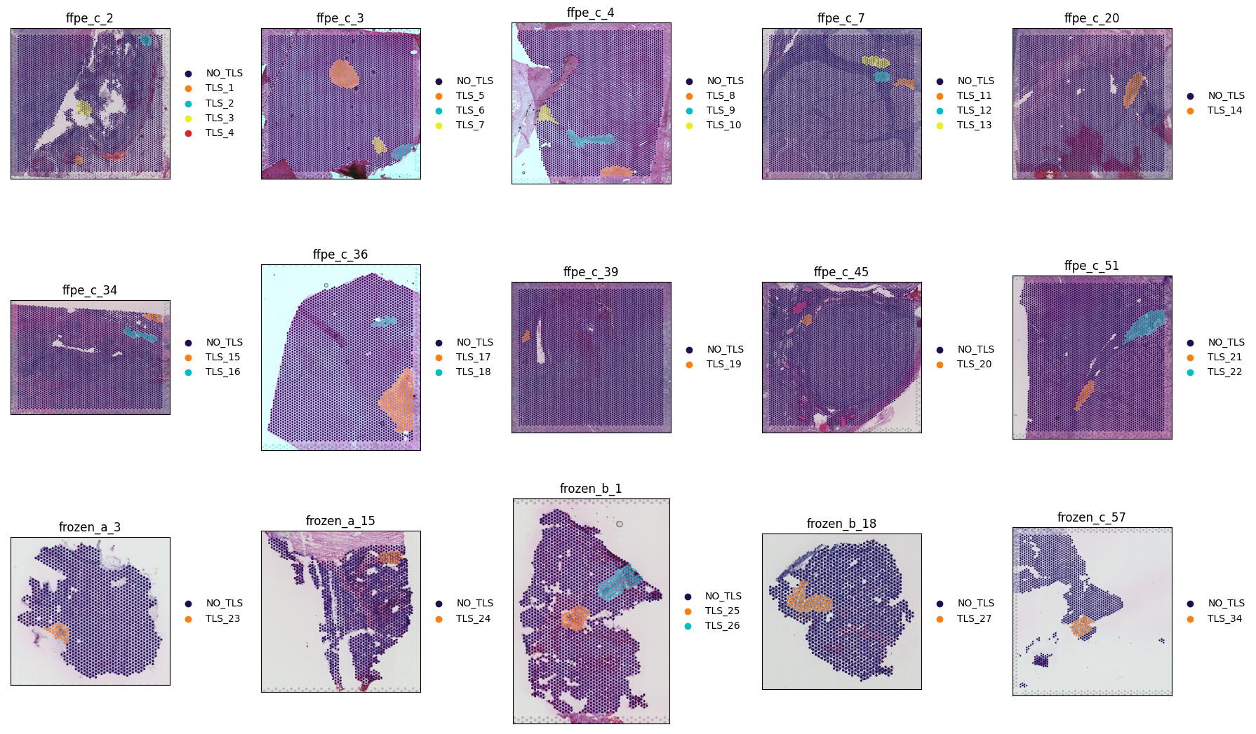 _images/Tutorial_4_Analyze_Tertiary_Lymphoid_Structures_on_ccRCC_6_0.png