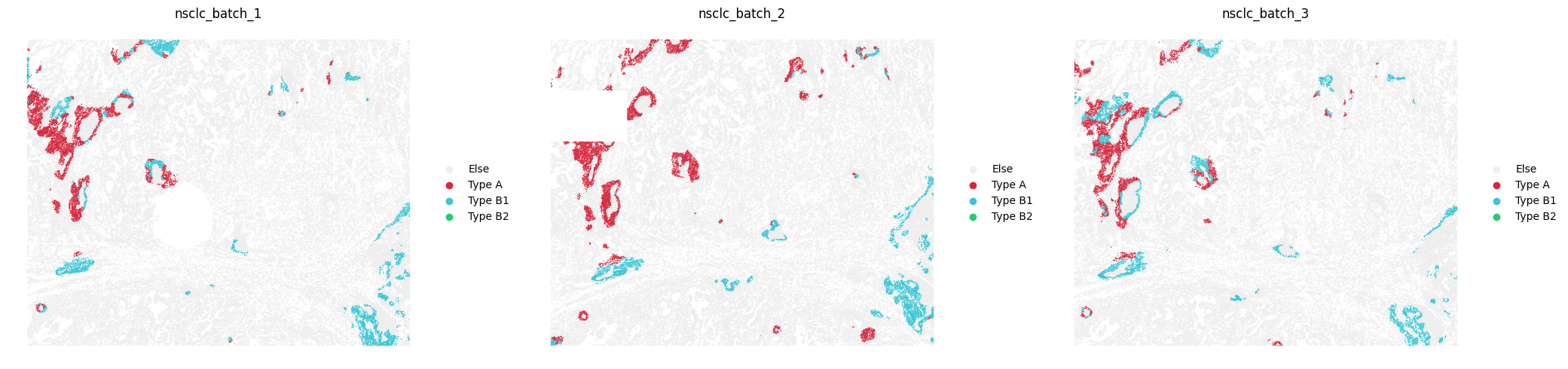 _images/Tutorial_5_Querying_ccRCC_TLS_subtypes_in_NSCLC_13_0.png